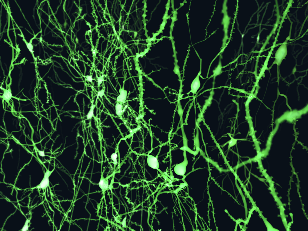 Metabolite in MS drug seems to slow onset of Parkinson's disease