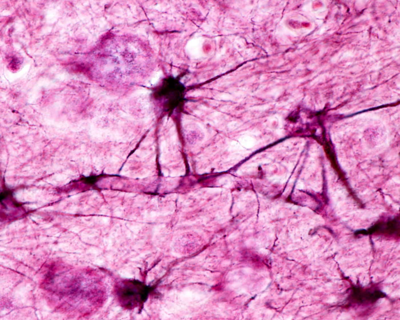 astrocyte histology