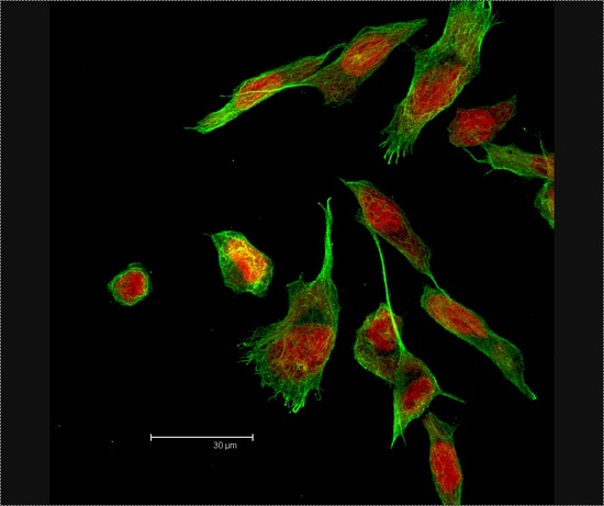 brain cells, young-onset Parkinson's