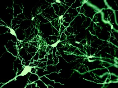 neuron structure changes