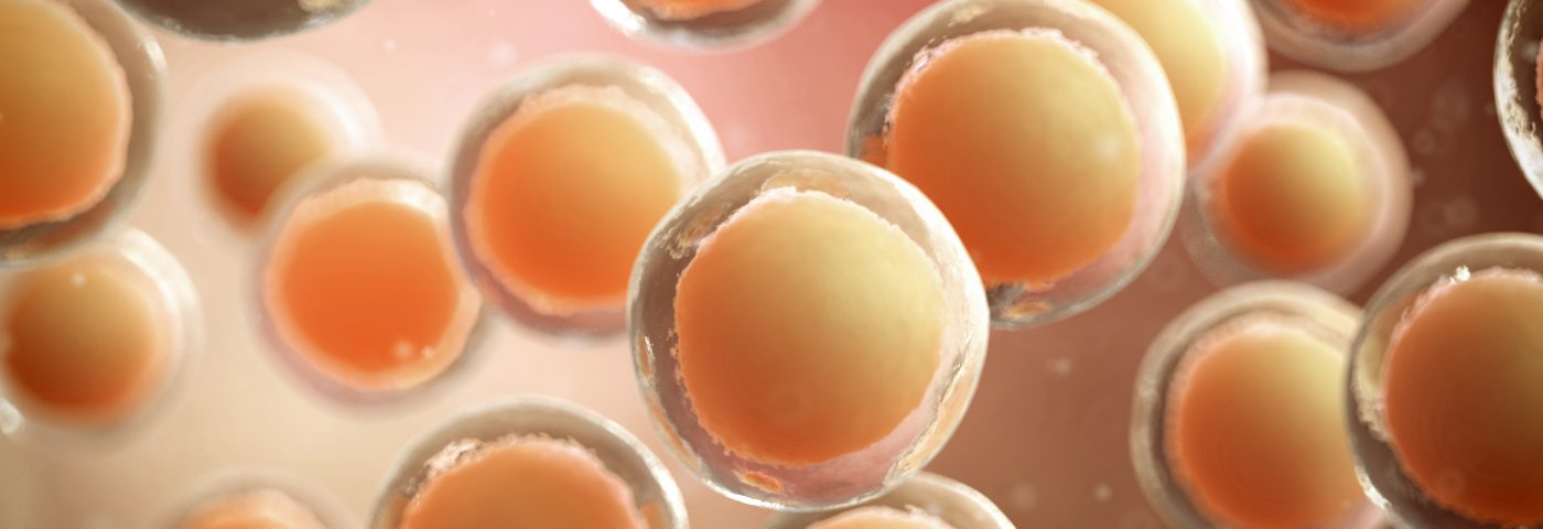 Future of Parkinson's Therapy Might Be in Unfertilized Human Egg Cells ...