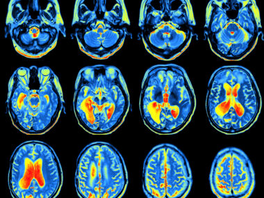 alpha-synuclein PET tracers