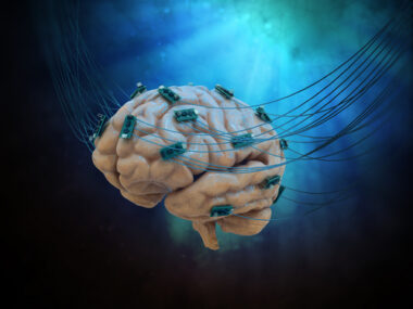 deep brain stimulation