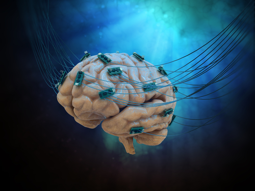 Deep-Brain Stimulation for Parkinson's Disease