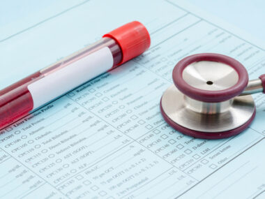 blood glucose levels