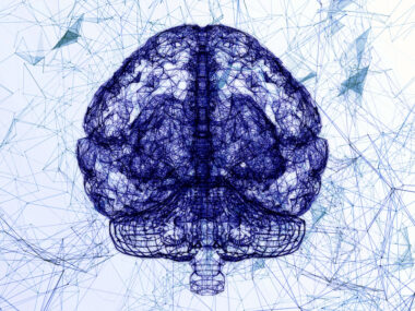 excess iron in brain