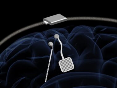 neuromodulator for Parkinson's