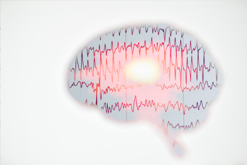 brainwaves EEG