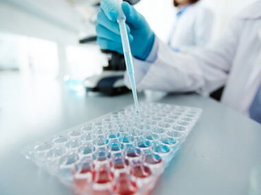 nanoparticles and amyloid clumps