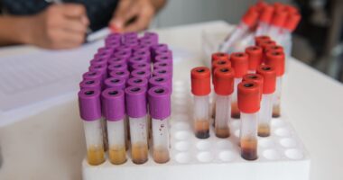 blood tests as diagnostic aid