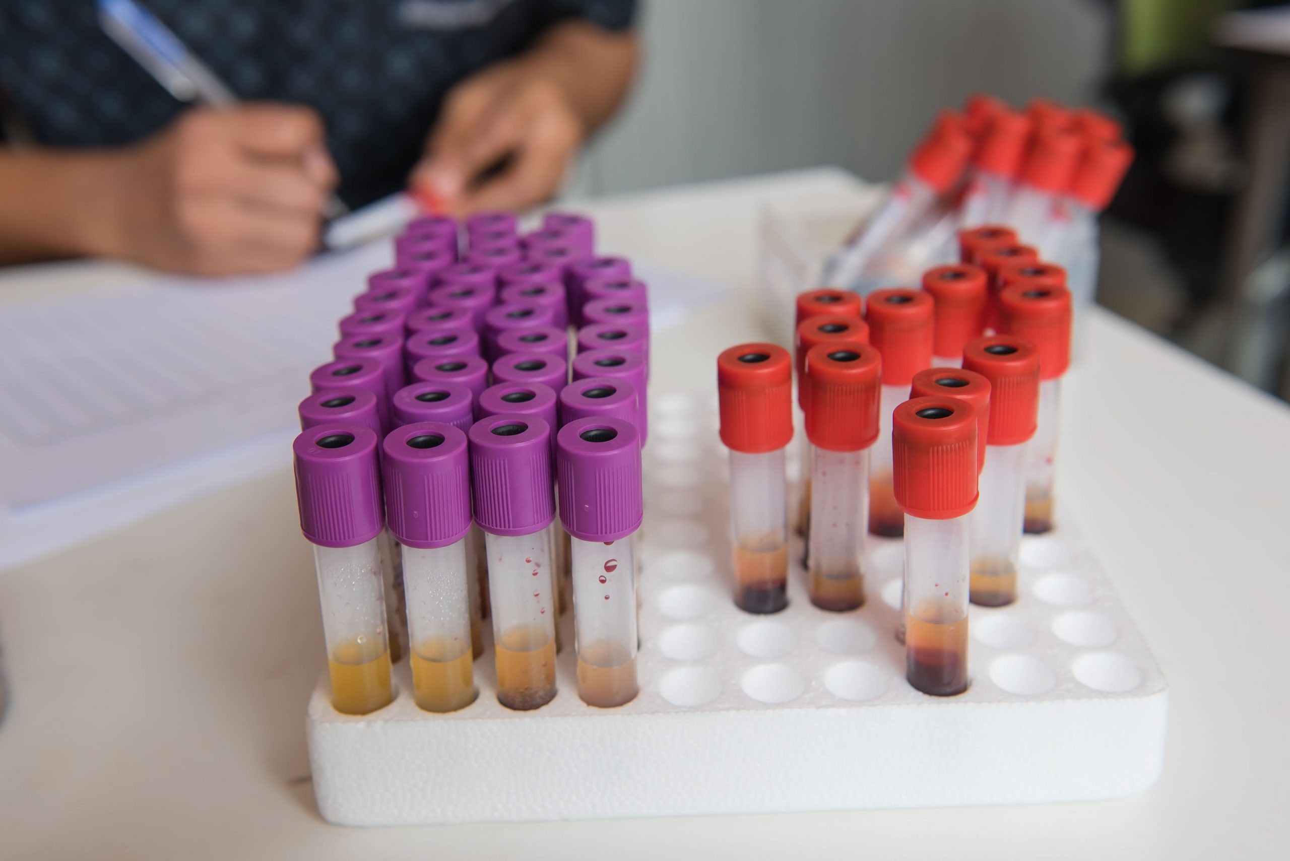 blood tests as diagnostic aid