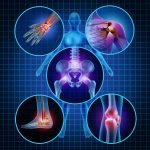 rheumatoid arthritis and Parkinson's