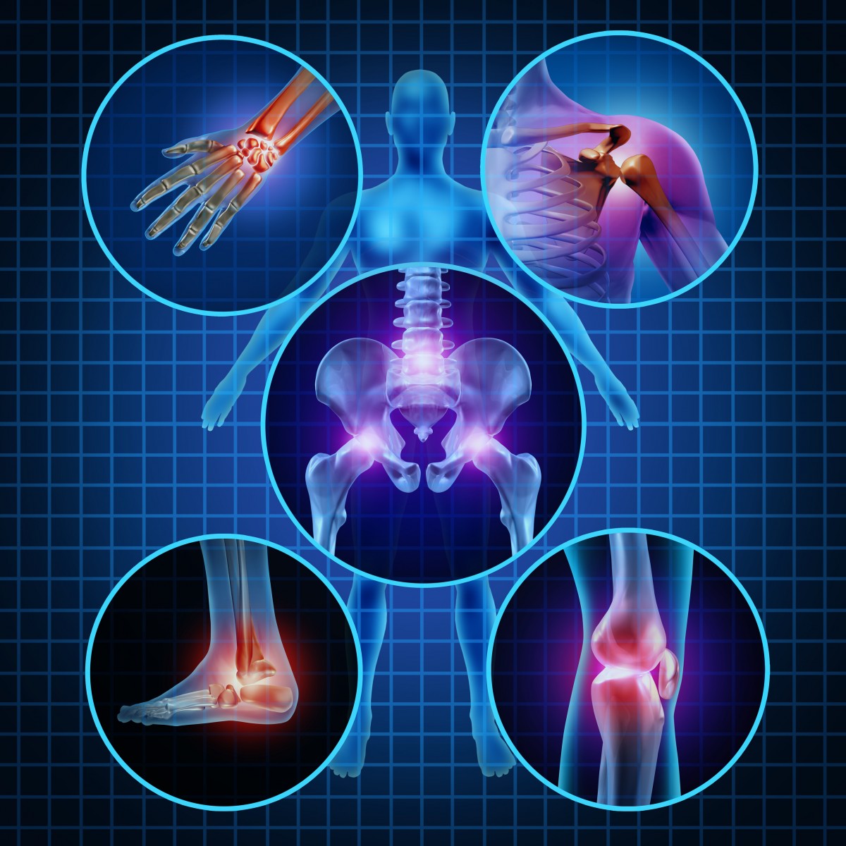 rheumatoid arthritis and Parkinson's