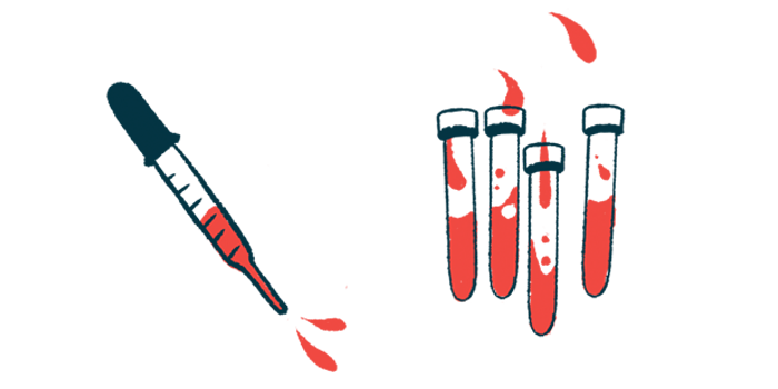 A dropper squirts out droplets of blood alongside several vials of blood.