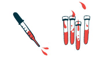 A dropper is shown next to four vials of blood.