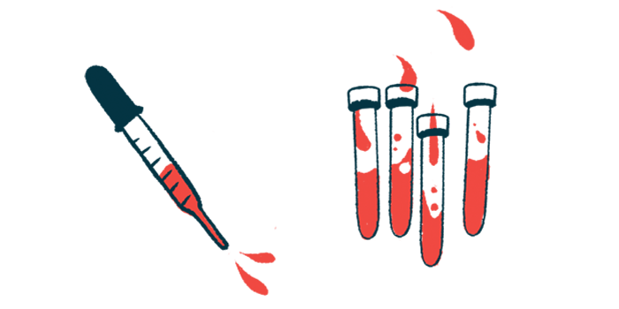 A dropper is shown next to four vials of blood.