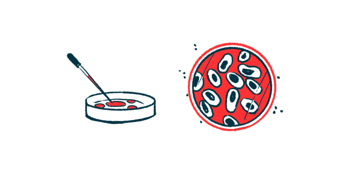 Nanoplastics worsen Parkinson's signs in worms, human cells