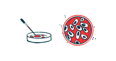 COVID-19 protein | Parkinson's News Today | illustration of cells in petri dish