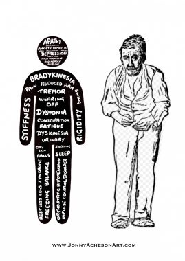 art therapy for Parkinson's disease |  Parkinson's News Today |  A side by side comparison of Jonny Acheson's modern Parkinson's figure and a Parkinson's figure drawn in 1886. Acheson's figure depicts a body with various symptoms of Parkinson's written on it.  The older Parkinson's figure depicts an older man leaning slightly forward.