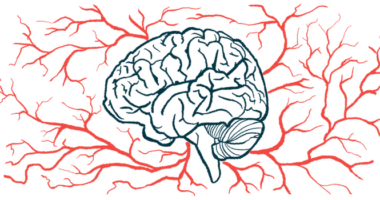 Multiple blood vessels surround a profile image of the human brain.