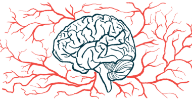 fibroblast growth factor-1 | Parkinson's News Today | illustration of human brain