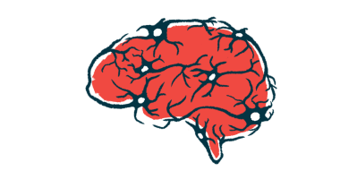 deep brain stimulation Parkinson's | Parkinson's News Today | illustration of the human brain