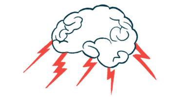 Lightning bolts shoot out from a brain in this close-up illustration.