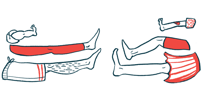 A illustration of legs extended toward each other is shown.