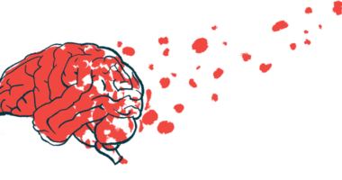 Illustration of a human brain.