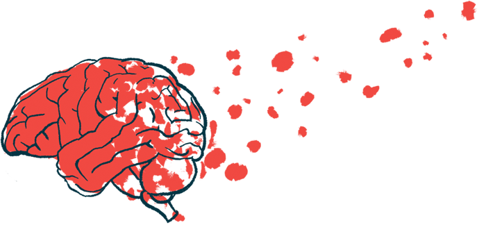 Illustration of a human brain.