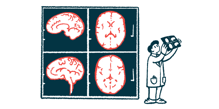 A doctor is shown looking at MRI scans of a person's brain.