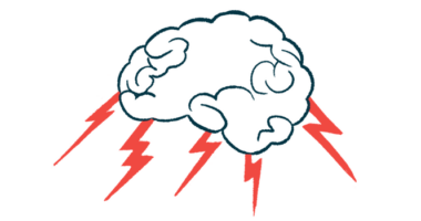 A human brain is shown with electric currents running across its base.
