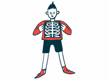 A person holds up a chest X-ray with two hands in front of the chest.