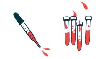 A squiring dropper is seen alongside four vials each half filled with blood.