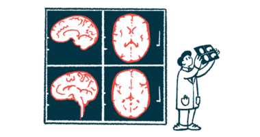 A researcher examines brain images, which are displayed larger behind him.