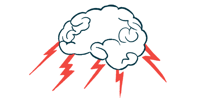 A brain is shown with lightning bolts about it.