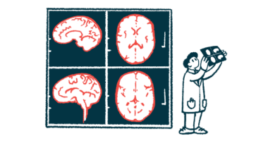 A medical professional views brain scans next to a giant image of a brain scan.