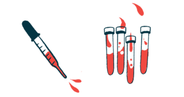 Vials of blood and a pipette are shown.