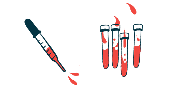 Vials of blood and a pipette are shown.