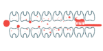 Illustration of toothbrush in between two rows of teeth.