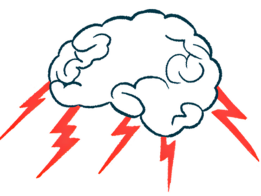 A brain emits lightning bolts like a thunder cloud.