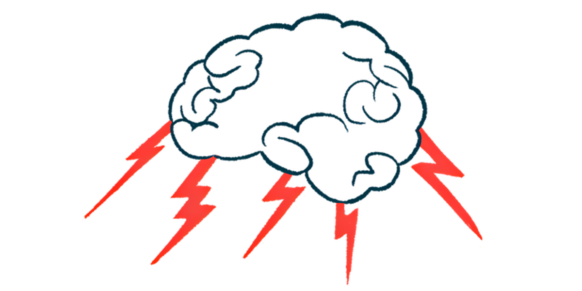 A brain emits lightning bolts like a thunder cloud.