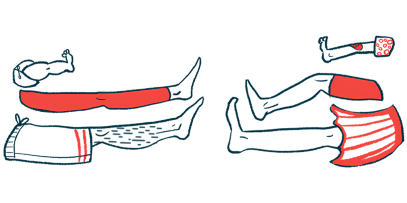 Six legs are shown extended toward each other, with three on each side.