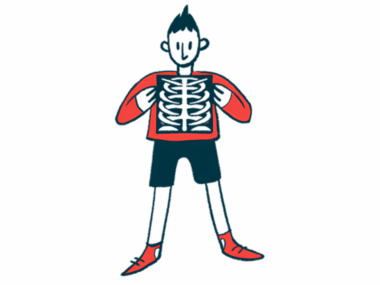 A man holds an X-ray of the rib cage in front of his chest.