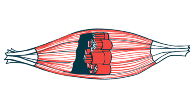 An illustration of muscles and their fibers.