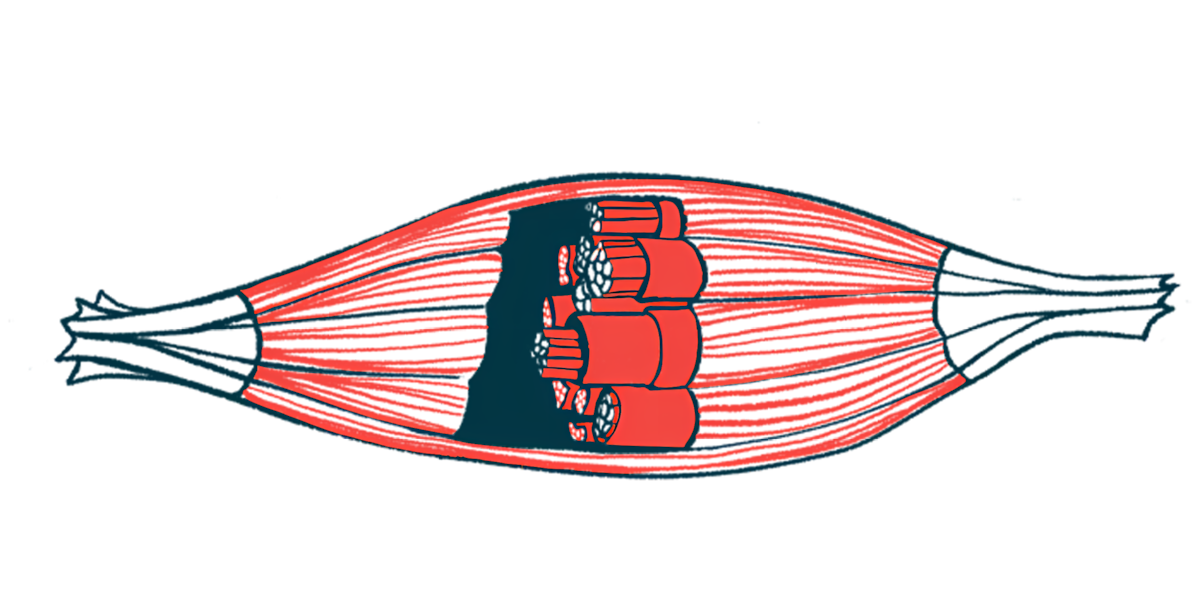 An illustration of muscles and their fibers.