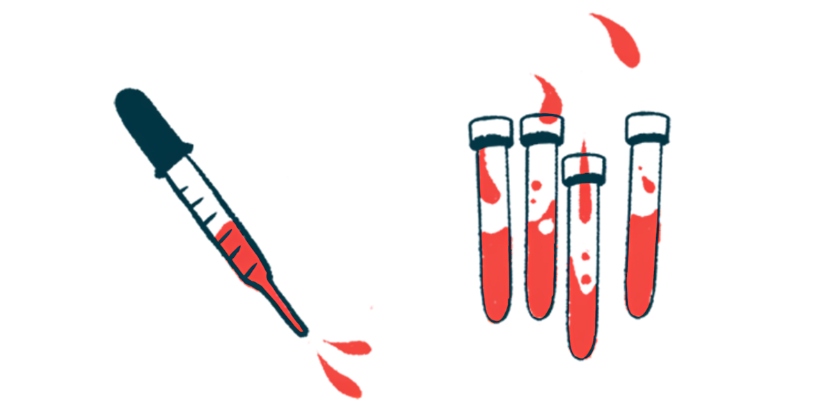 A tube is seen squirting drops of a liquid as drops collect in nearby lab vials.