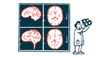 A doctor is shown looking at scans of a person's brain.