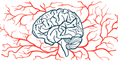 Blood vessels surround a brain.