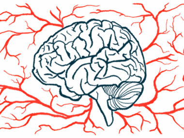 Blood vessels surround a brain.